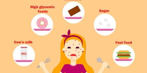 Acne van binnenuit behandelen met voeding