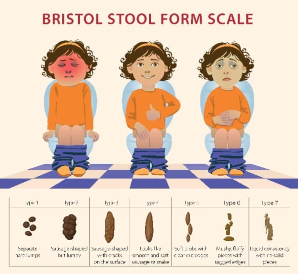 Bristol stool chart