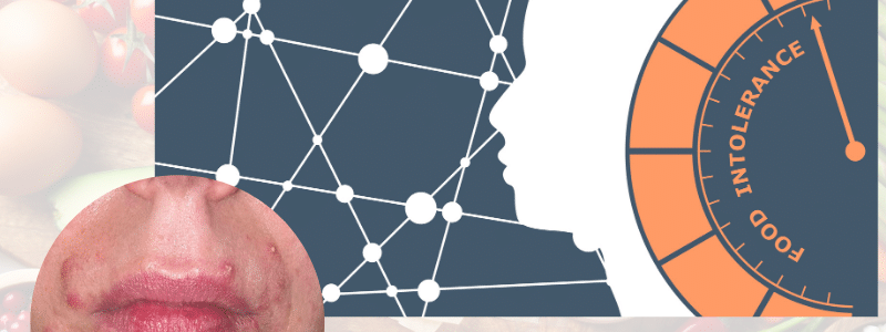 De invloed van voeding bij clownseczeem