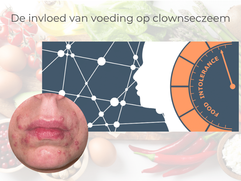De invloed van voeding bij clownseczeem