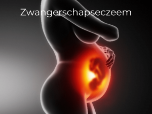 Zwangere vrouw met eczeem