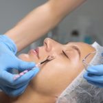 Toepassing van een chemische peeling behandeling