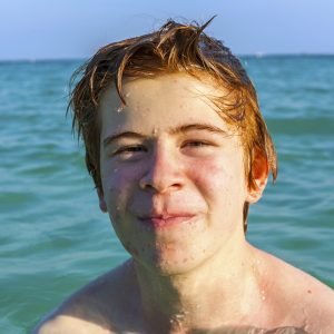 Jongeman met Mallorca-acne op het gezicht