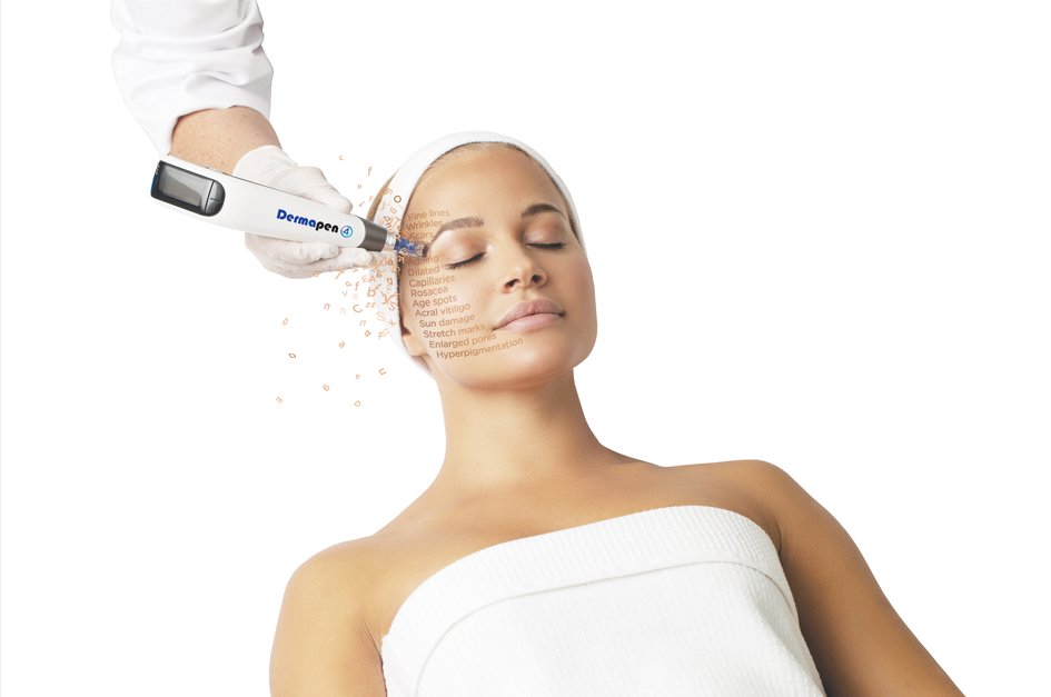 Microneedling Haarlem BB-Huidverbetering