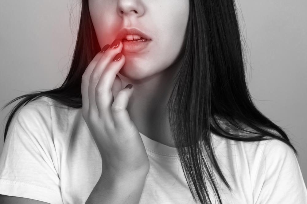 Verschil clownseczeem herpes en krentenbaard huid rond mond