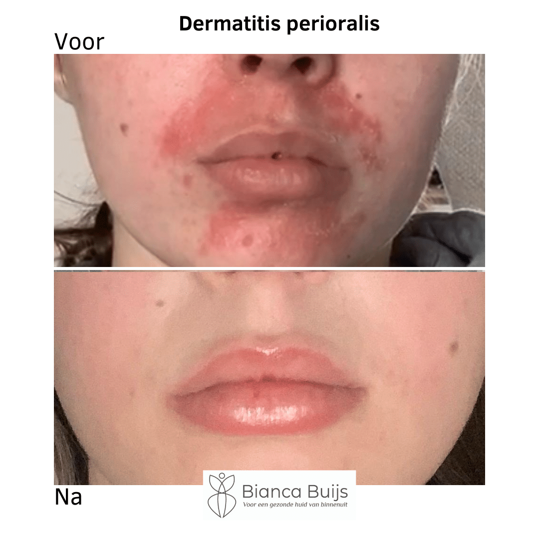 Voor/Na foto 1