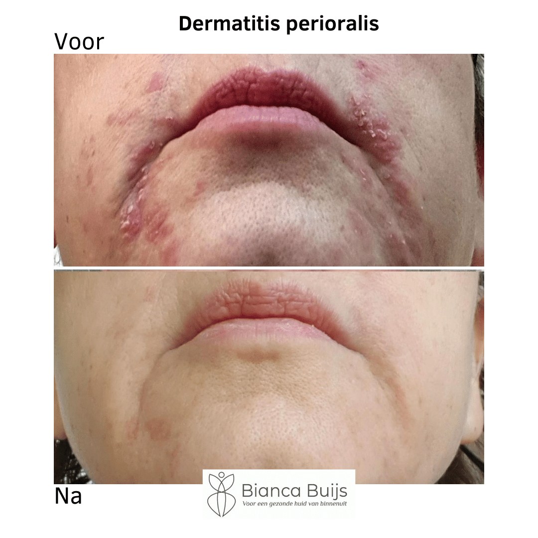 Voor/Na foto 2